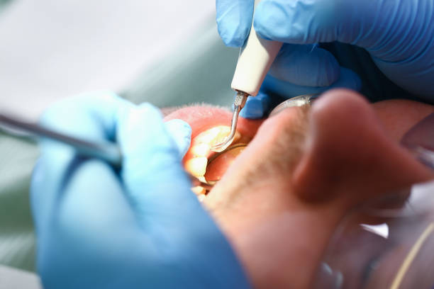 Best Broken Tooth Emergency  in Jermyn, PA