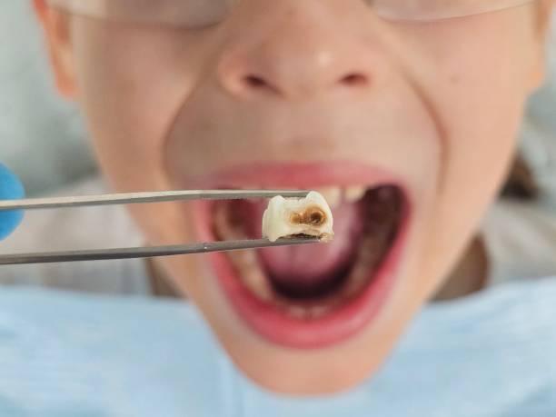 Best Root Canal Emergency Dentist  in Jermyn, PA